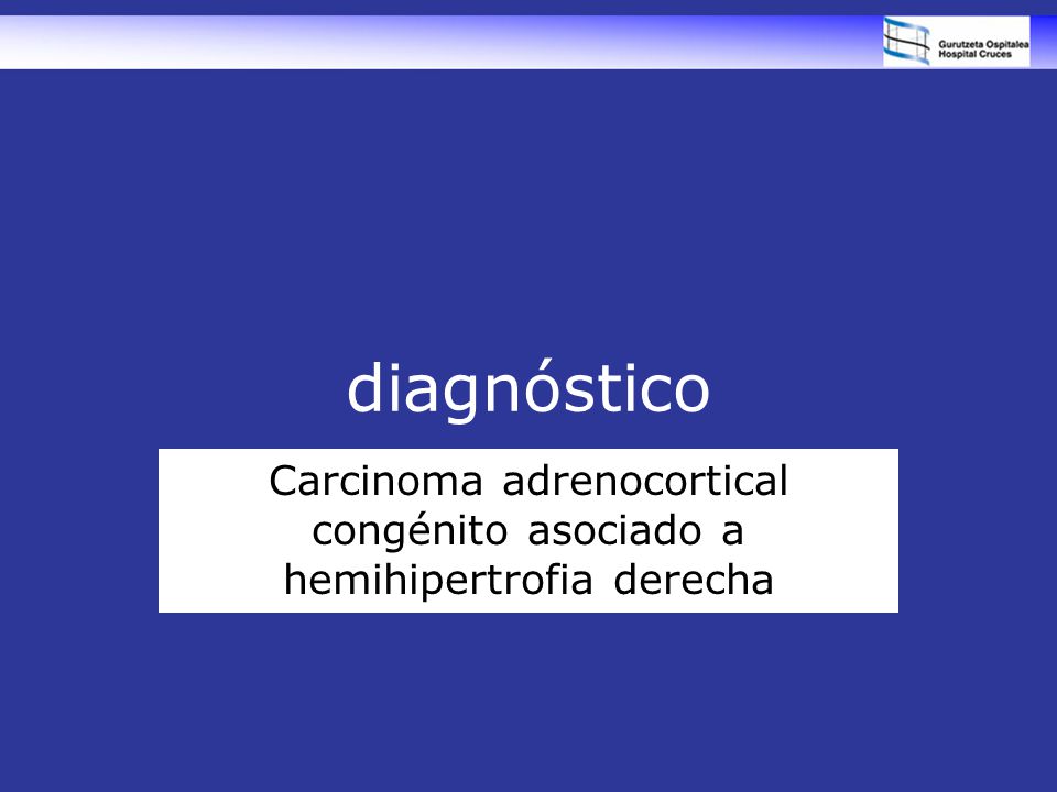 Carcinoma adrenocortical congénito asociado a hemihipertrofia derecha