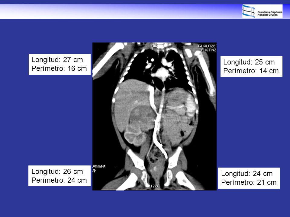 Longitud: 27 cm Perímetro: 16 cm. Longitud: 25 cm. Perímetro: 14 cm. Longitud: 26 cm. Perímetro: 24 cm.
