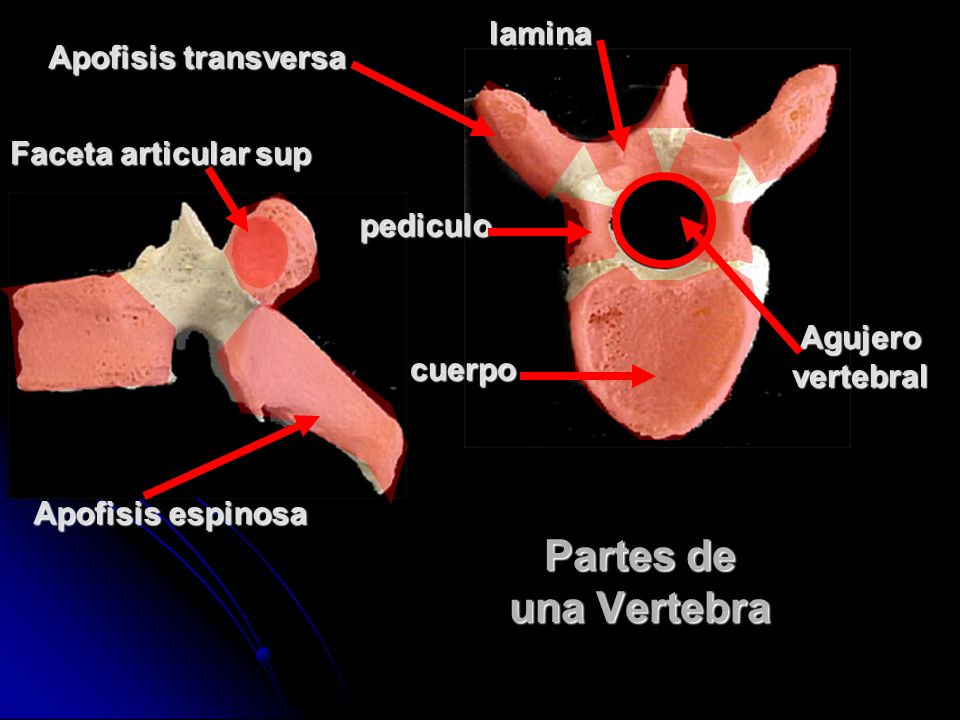 Partes de una Vertebra lamina Apofisis transversa Faceta articular sup