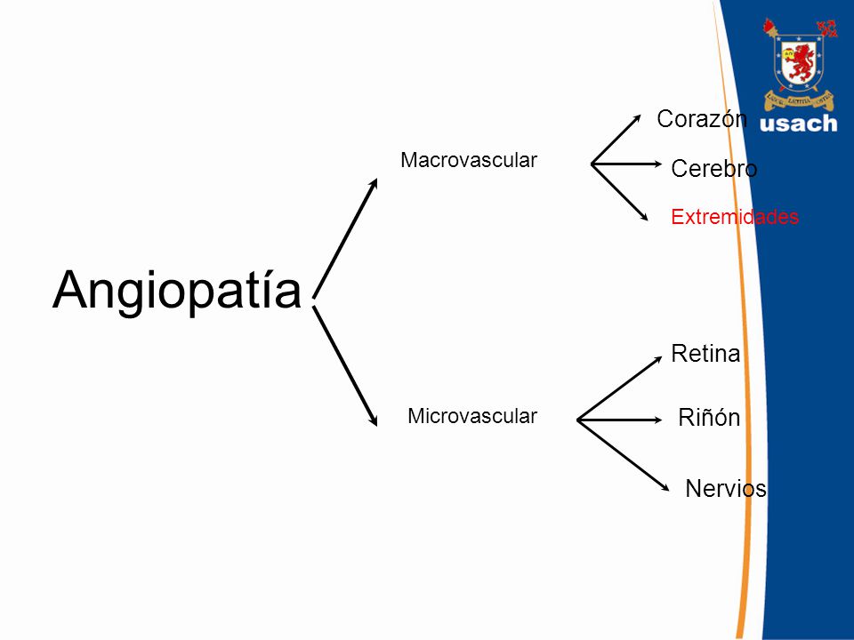 Angiopatía Corazón Cerebro Retina Riñón Nervios Macrovascular