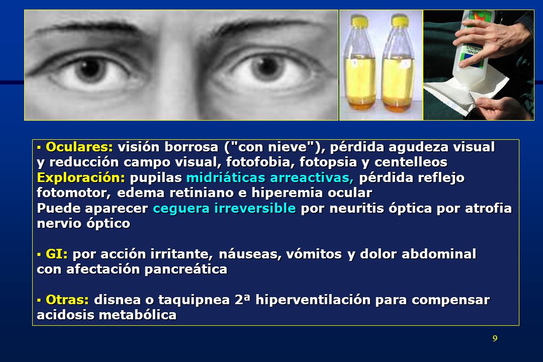 ▪ Oculares: visión borrosa ( con nieve ), pérdida agudeza visual