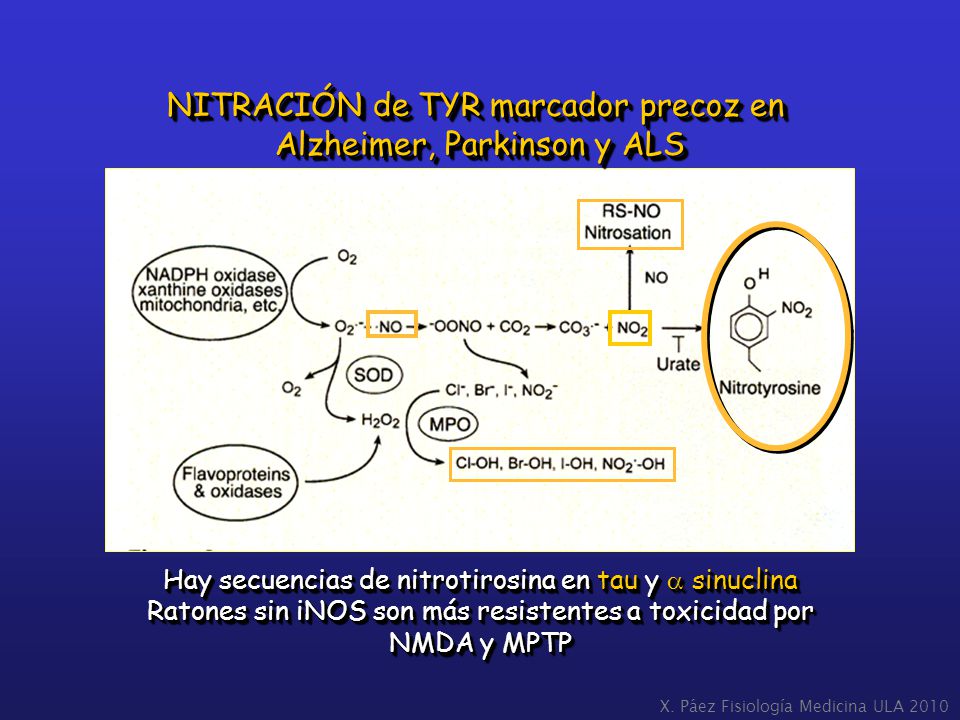 NITRACIÓN de TYR marcador precoz en Alzheimer, Parkinson y ALS