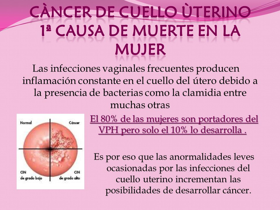 CÀNCER DE CUELLO ÙTERINO 1ª CAUSA DE MUERTE EN LA MUJER