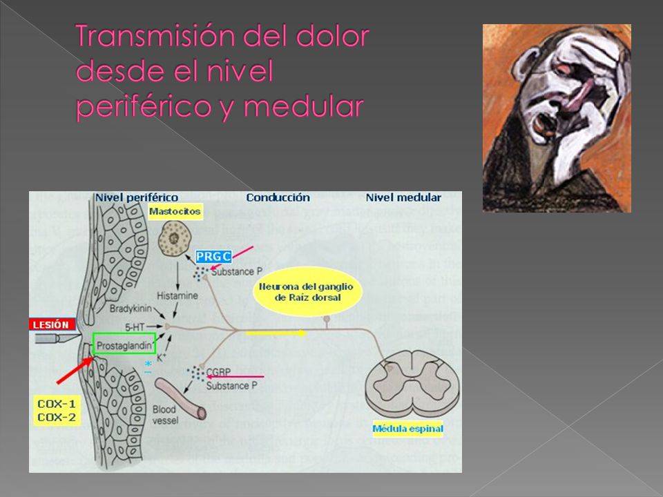 Transmisión del dolor desde el nivel periférico y medular