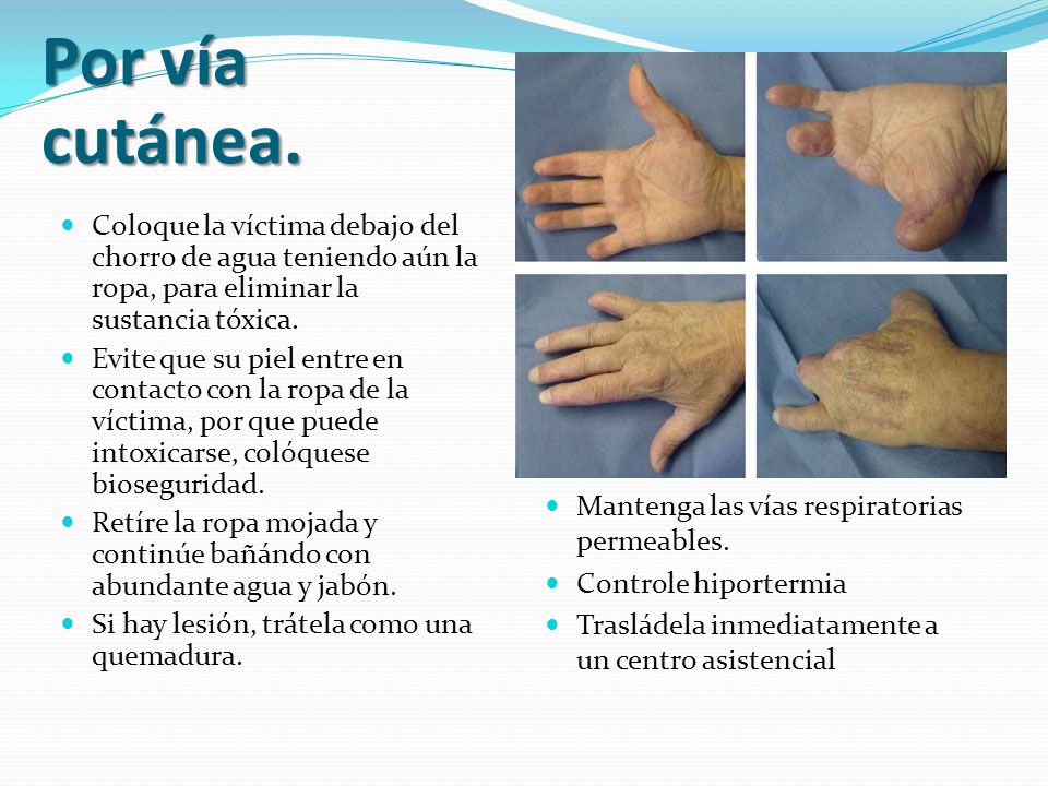 Por vía cutánea. Coloque la víctima debajo del chorro de agua teniendo aún la ropa, para eliminar la sustancia tóxica.