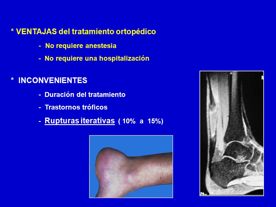 * VENTAJAS del tratamiento ortopédico - No requiere anestesia