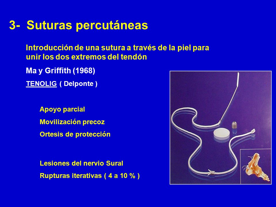 3- Suturas percutáneas Introducción de una sutura a través de la piel para unir los dos extremos del tendón.