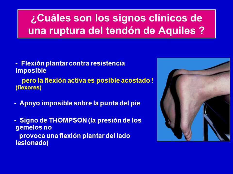 ¿Cuáles son los signos clínicos de una ruptura del tendón de Aquiles