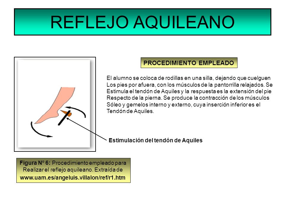 REFLEJO AQUILEANO PROCEDIMIENTO EMPLEADO