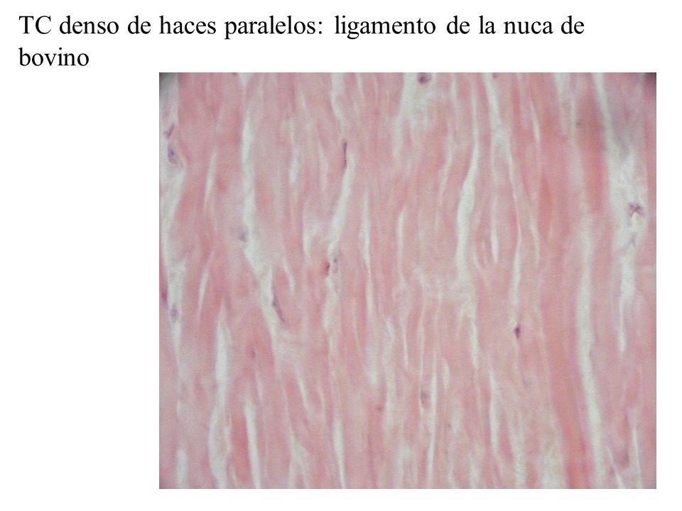 TC denso de haces paralelos: ligamento de la nuca de bovino