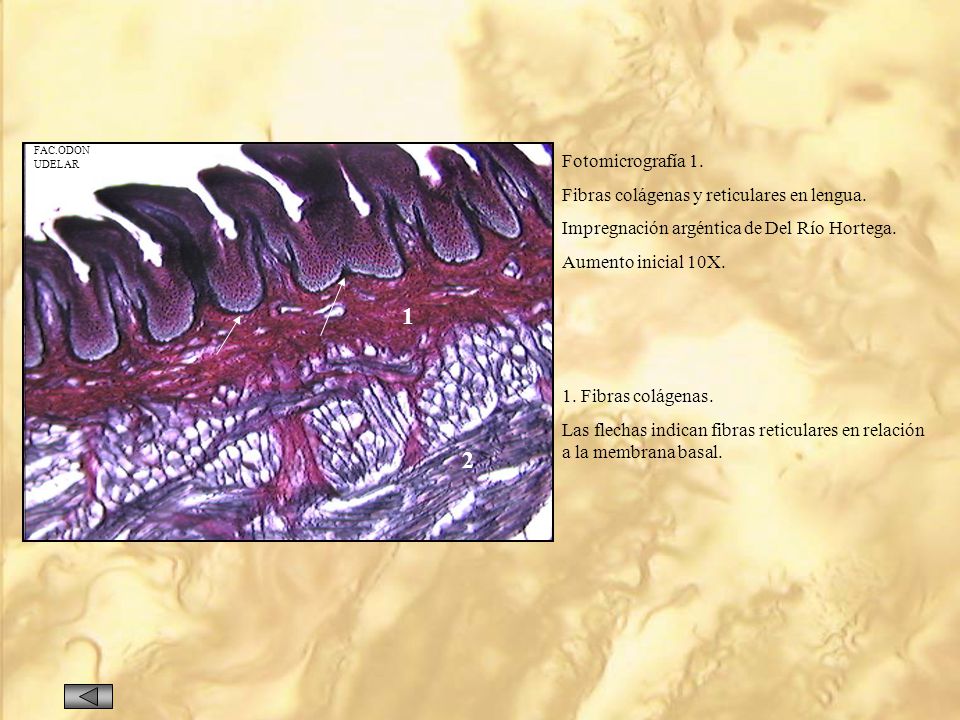 1 2 Fotomicrografía 1. Fibras colágenas y reticulares en lengua.