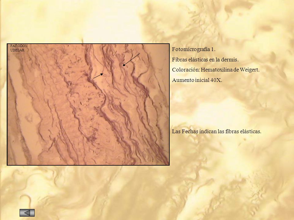 Fibras elásticas en la dermis. Coloración: Hematoxilina de Weigert.