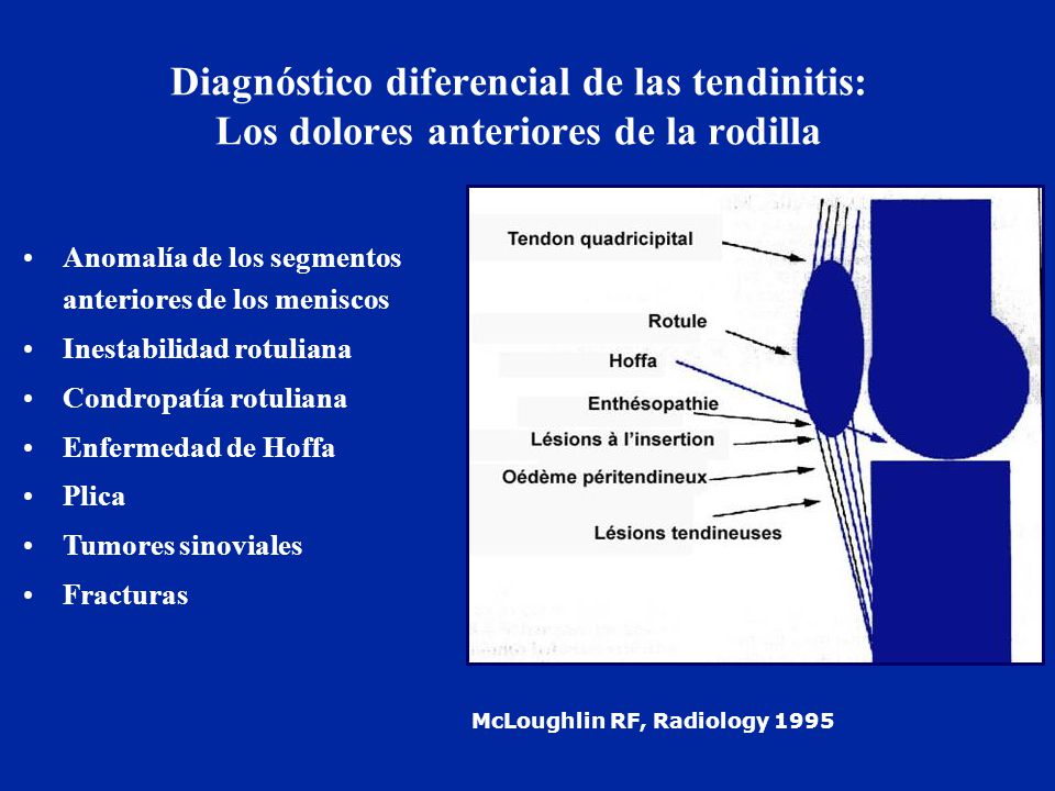 Diagnóstico diferencial de las tendinitis: Los dolores anteriores de la rodilla