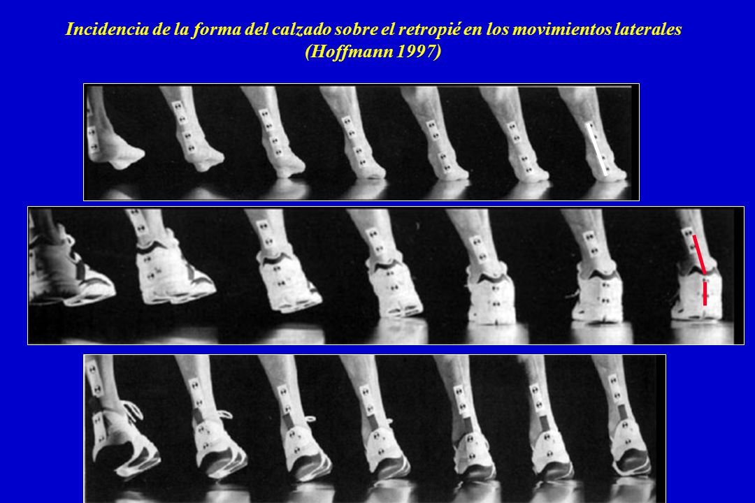 Incidencia de la forma del calzado sobre el retropié en los movimientos laterales (Hoffmann 1997)