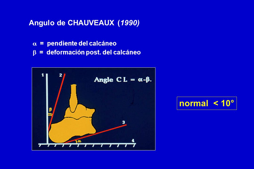 normal < 10° Angulo de CHAUVEAUX (1990) a = pendiente del calcáneo