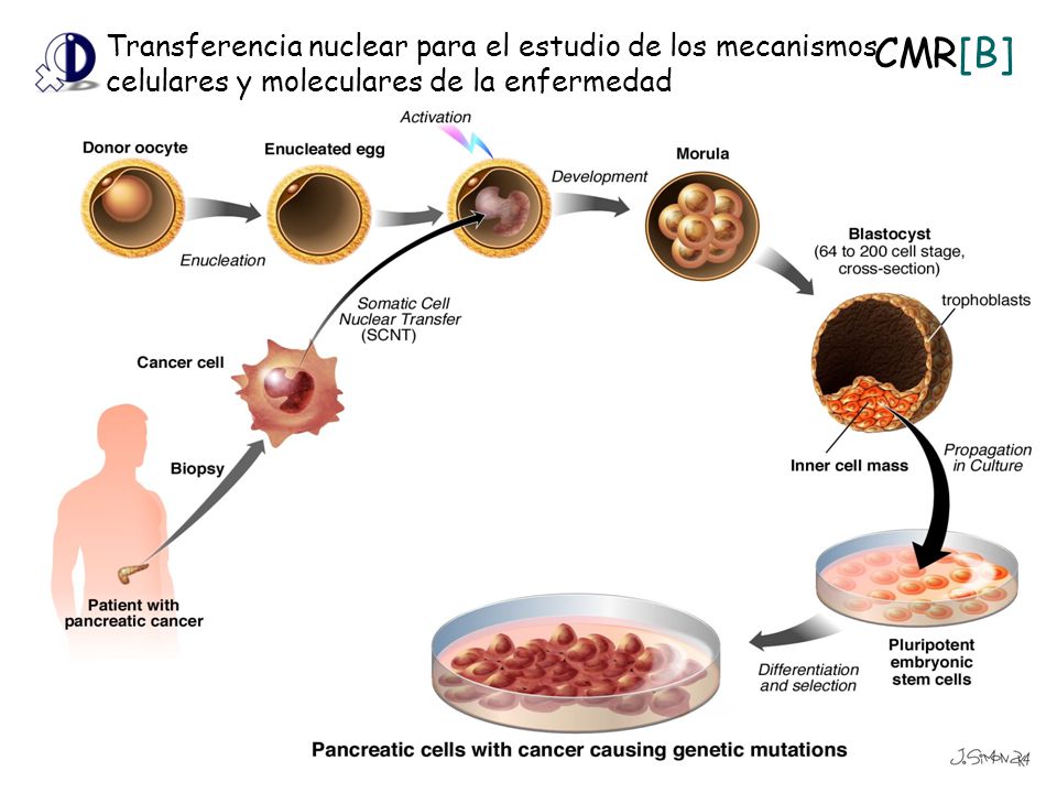 Transferencia nuclear para el estudio de los mecanismos celulares y moleculares de la enfermedad