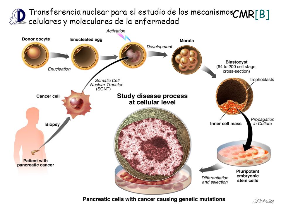 Transferencia nuclear para el estudio de los mecanismos celulares y moleculares de la enfermedad
