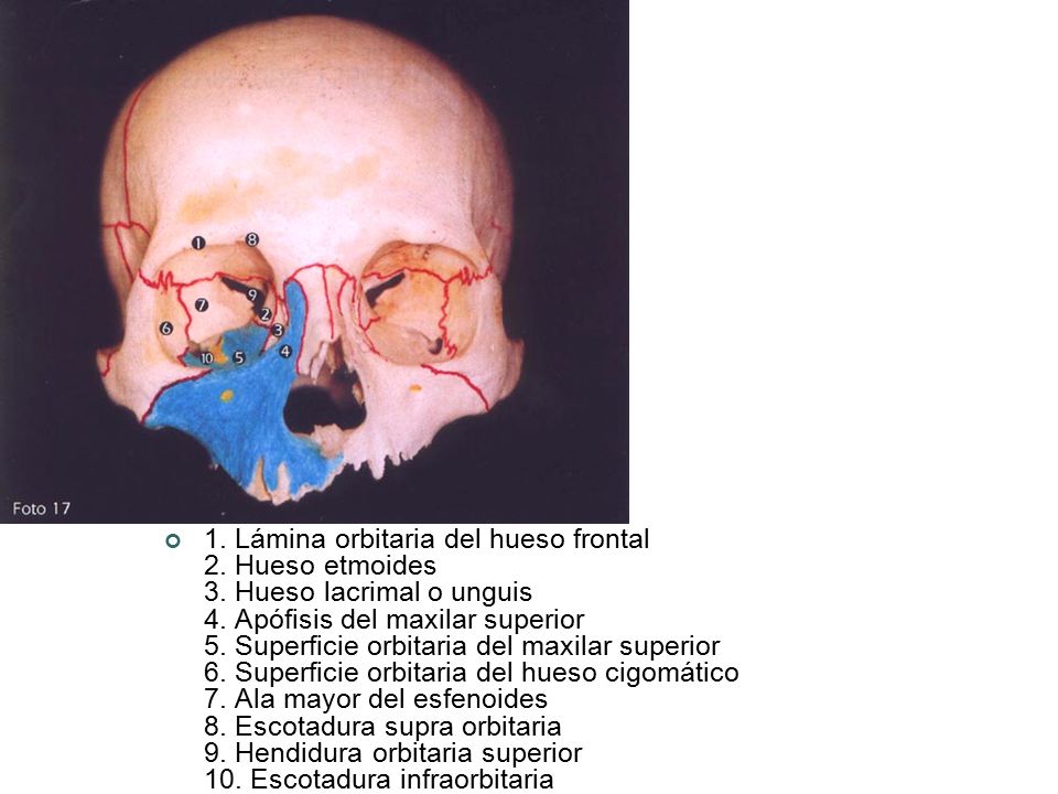 1. Lámina orbitaria del hueso frontal 2. Hueso etmoides 3