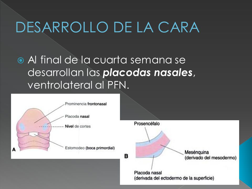 DESARROLLO DE LA CARA Al final de la cuarta semana se desarrollan las placodas nasales, ventrolateral al PFN.