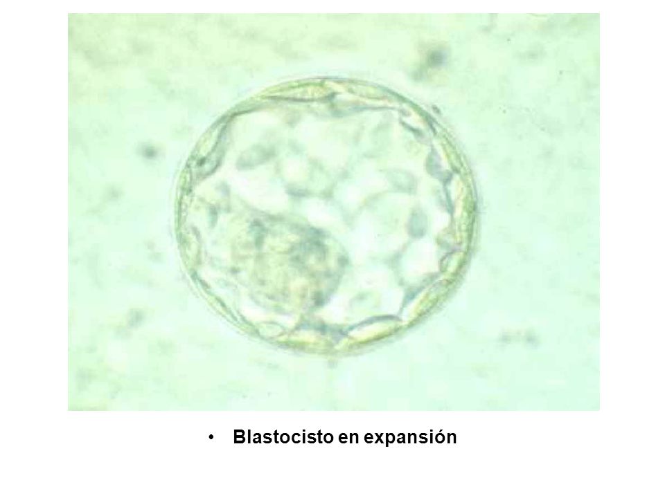 Blastocisto en expansión