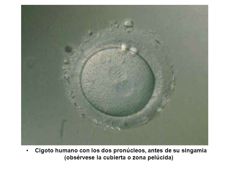 Cigoto humano con los dos pronúcleos, antes de su singamia (obsérvese la cubierta o zona pelúcida)