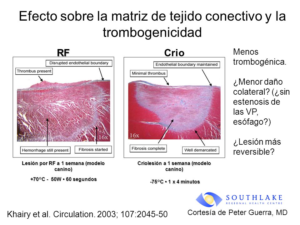 Efecto sobre la matriz de tejido conectivo y la trombogenicidad