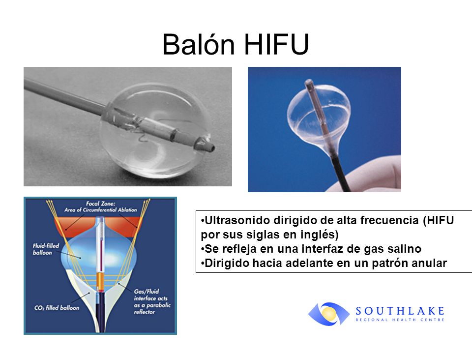 Balón HIFU Ultrasonido dirigido de alta frecuencia (HIFU por sus siglas en inglés) Se refleja en una interfaz de gas salino.
