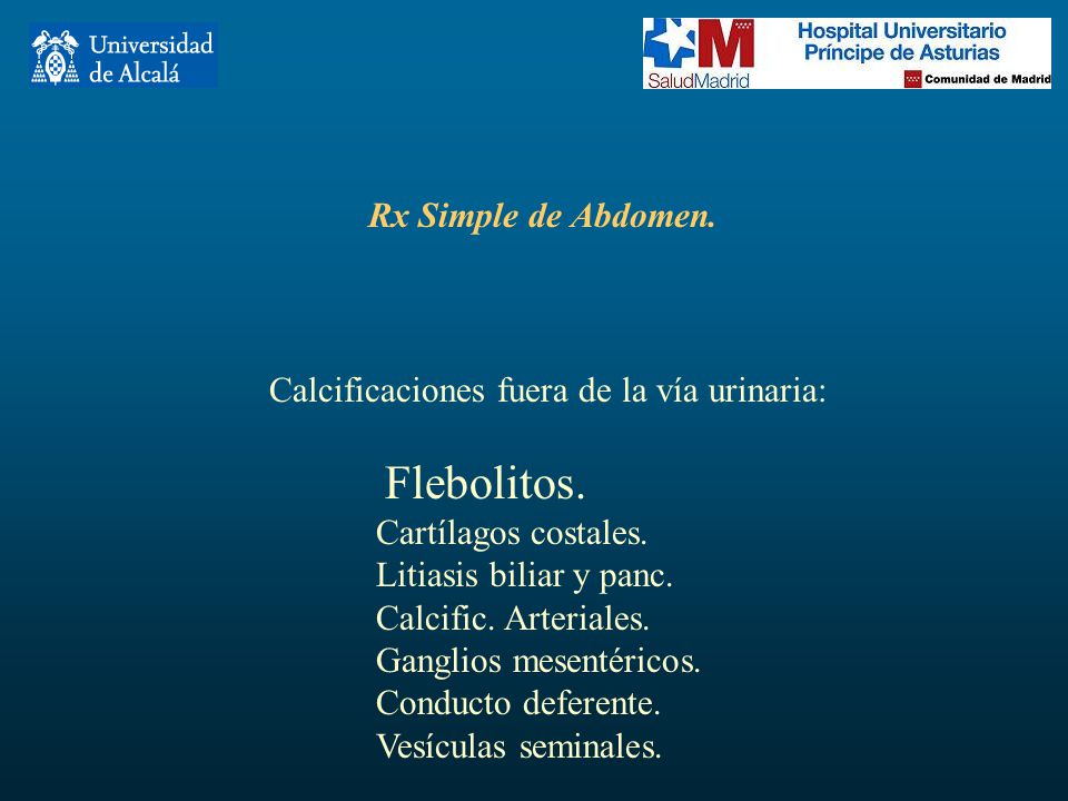 Rx Simple de Abdomen. Calcificaciones fuera de la vía urinaria: Flebolitos. Cartílagos costales. Litiasis biliar y panc.
