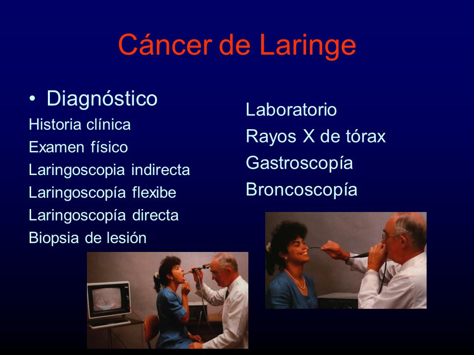 Cáncer de Laringe Diagnóstico Laboratorio Rayos X de tórax
