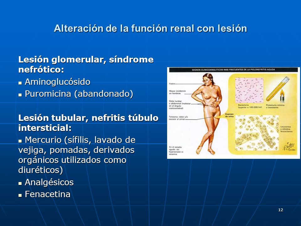 Alteración de la función renal con lesión
