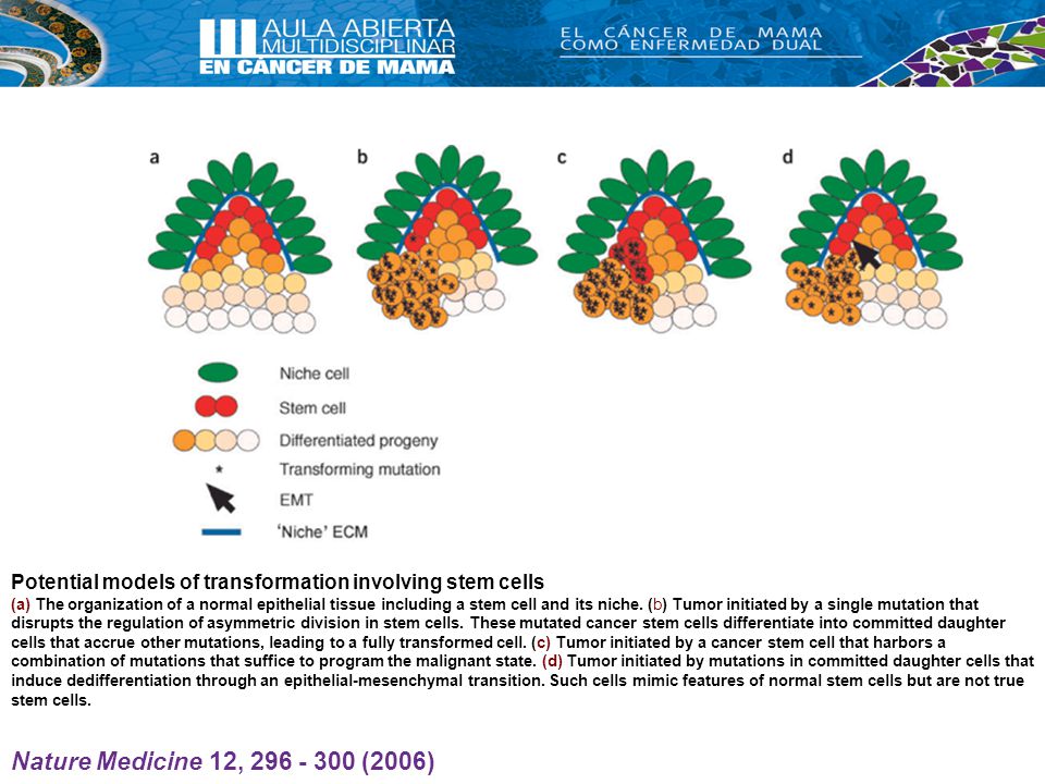 Potential models of transformation involving stem cells (a) The organization of a normal epithelial tissue including a stem cell and its niche. (b) Tumor initiated by a single mutation that disrupts the regulation of asymmetric division in stem cells. These mutated cancer stem cells differentiate into committed daughter cells that accrue other mutations, leading to a fully transformed cell. (c) Tumor initiated by a cancer stem cell that harbors a combination of mutations that suffice to program the malignant state. (d) Tumor initiated by mutations in committed daughter cells that induce dedifferentiation through an epithelial-mesenchymal transition. Such cells mimic features of normal stem cells but are not true stem cells.