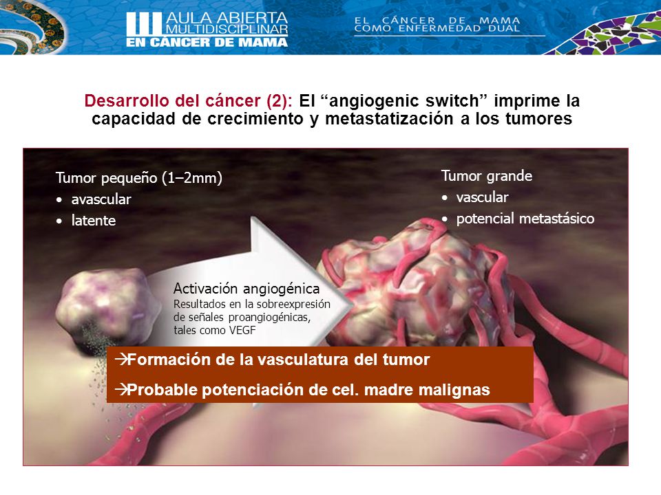 Desarrollo del cáncer (2): El angiogenic switch imprime la capacidad de crecimiento y metastatización a los tumores