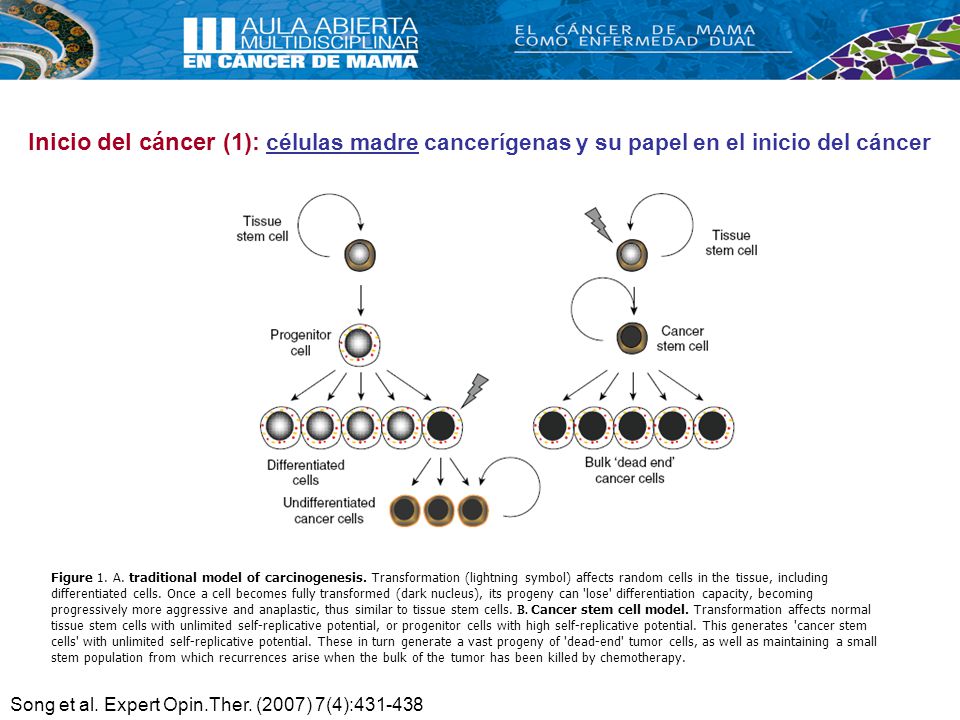 Inicio del cáncer (1): células madre cancerígenas y su papel en el inicio del cáncer
