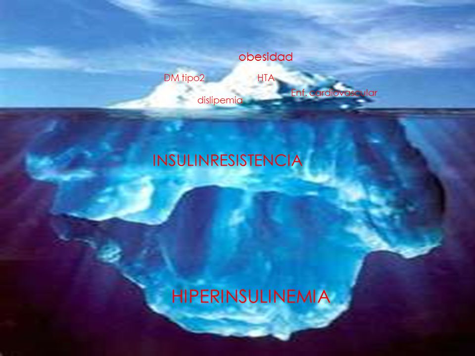 HIPERINSULINEMIA INSULINRESISTENCIA obesidad DM tipo2 HTA