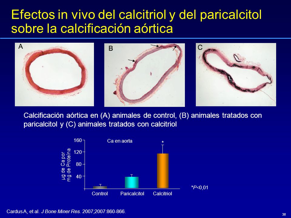 Efectos in vivo del calcitriol y del paricalcitol sobre la calcificación aórtica