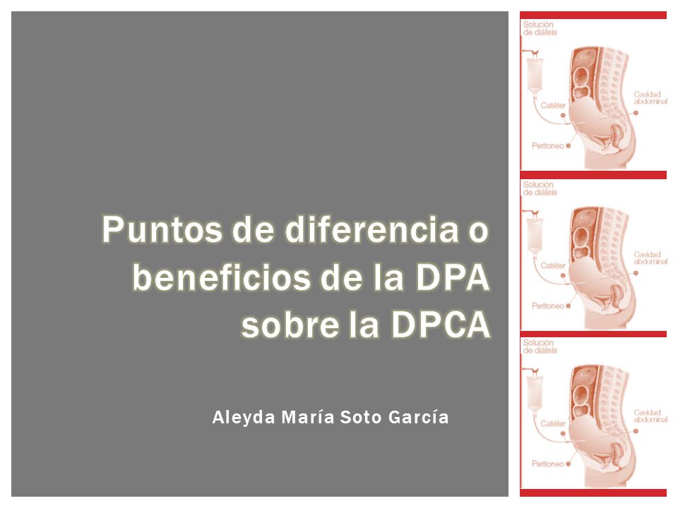 Puntos de diferencia o beneficios de la DPA sobre la DPCA