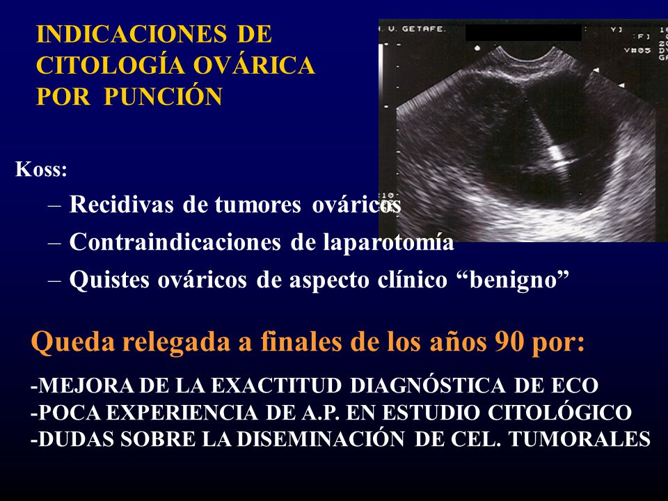 Queda relegada a finales de los años 90 por: