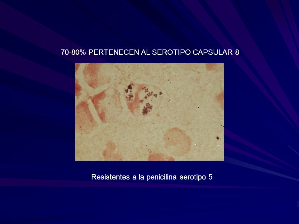 70-80% PERTENECEN AL SEROTIPO CAPSULAR 8