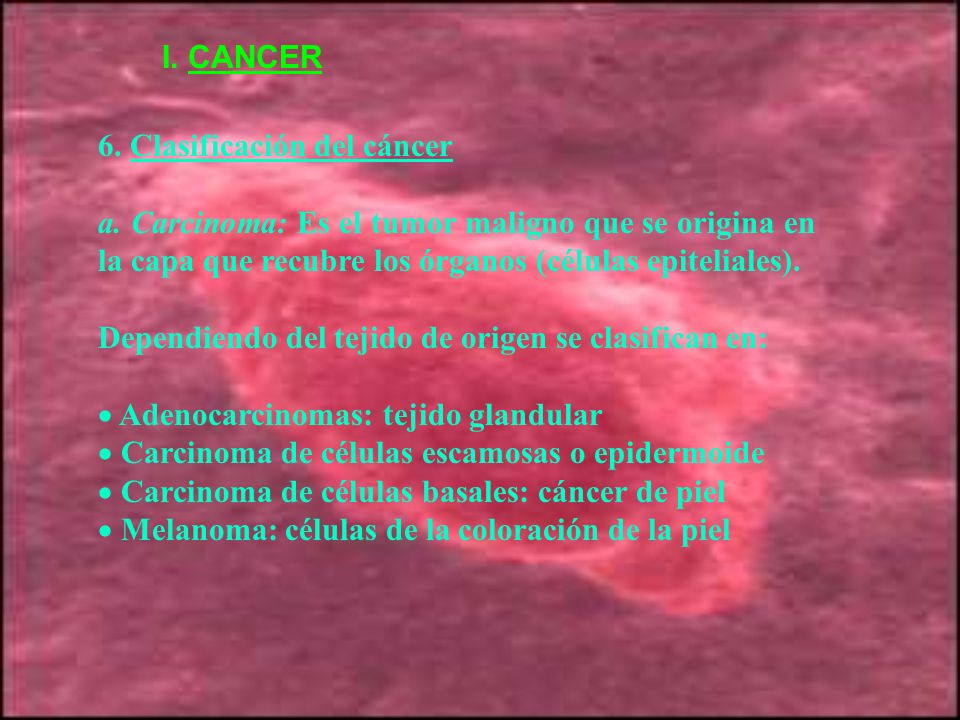 I. CANCER 6. Clasificación del cáncer. a. Carcinoma: Es el tumor maligno que se origina en la capa que recubre los órganos (células epiteliales).