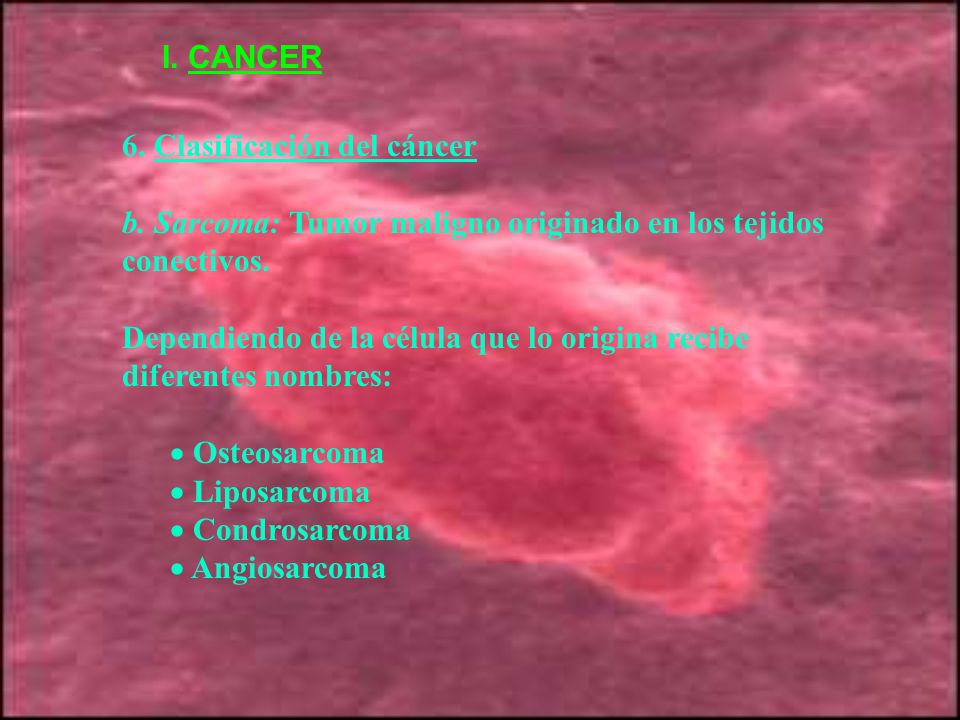 I. CANCER 6. Clasificación del cáncer. b. Sarcoma: Tumor maligno originado en los tejidos conectivos.
