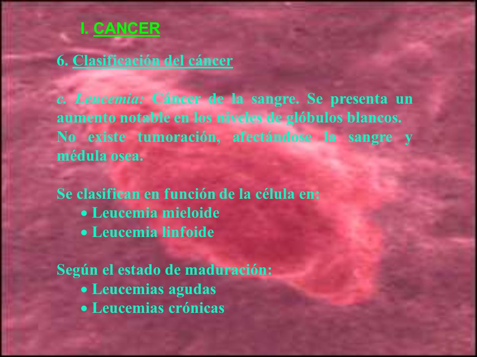 I. CANCER 6. Clasificación del cáncer. c. Leucemia: Cáncer de la sangre. Se presenta un aumento notable en los niveles de glóbulos blancos.