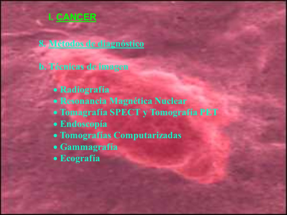 I. CANCER 8. Métodos de diagnóstico. b. Técnicas de imagen. Radiografía. Resonancia Magnética Nuclear.