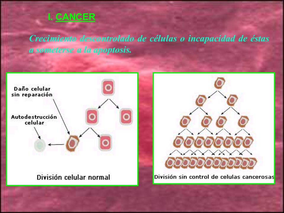 I. CANCER Crecimiento descontrolado de células o incapacidad de éstas a someterse a la apoptosis.