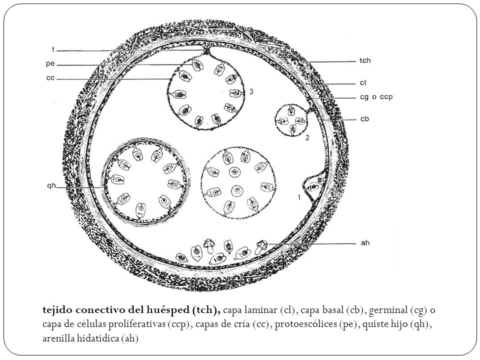 tejido conectivo del huésped (tch), capa laminar (cl), capa basal (cb), germinal (cg) o capa de células proliferativas (ccp), capas de cría (cc), protoescólices (pe), quiste hijo (qh), arenilla hidatidica (ah)