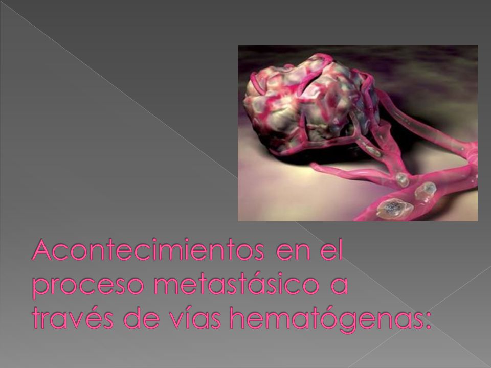 Acontecimientos en el proceso metastásico a través de vías hematógenas:
