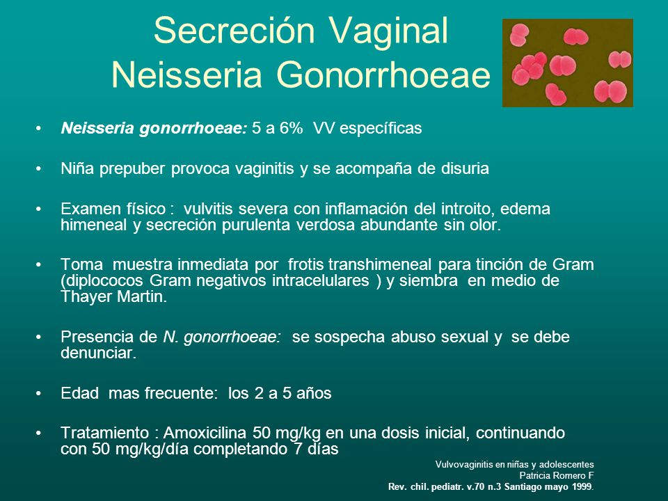 Secreción Vaginal Neisseria Gonorrhoeae