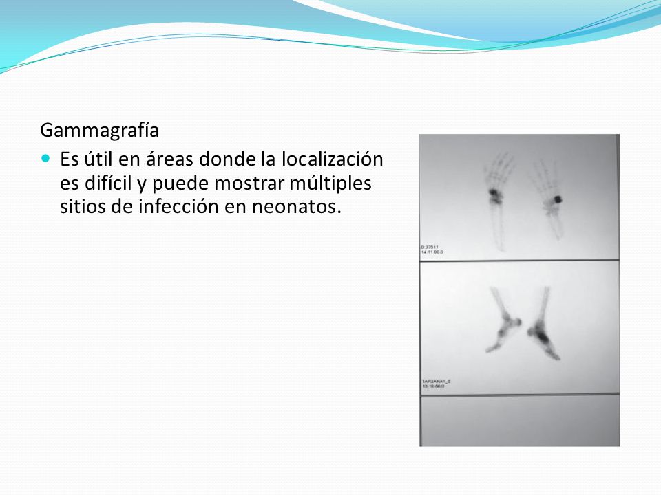 Gammagrafía Es útil en áreas donde la localización es difícil y puede mostrar múltiples sitios de infección en neonatos.