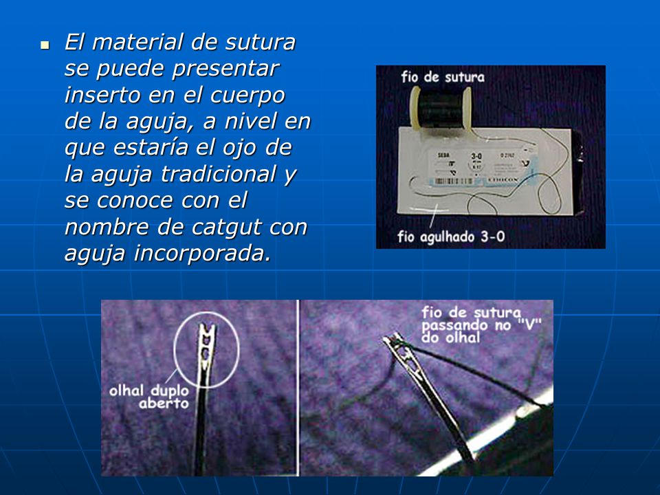 El material de sutura se puede presentar inserto en el cuerpo de la aguja, a nivel en que estaría el ojo de la aguja tradicional y se conoce con el nombre de catgut con aguja incorporada.