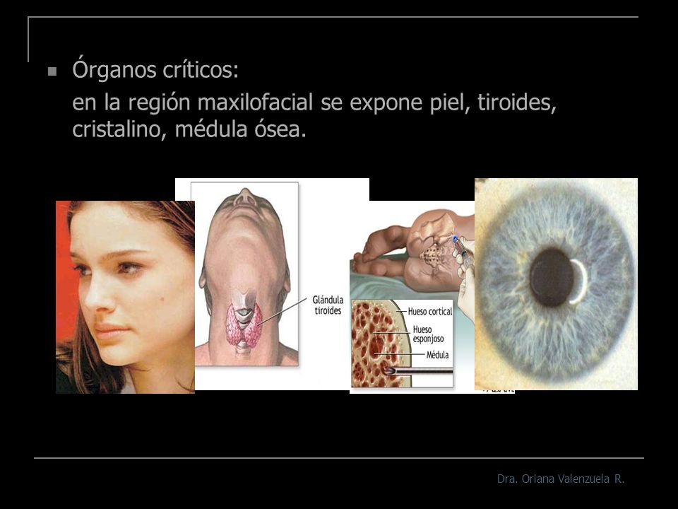 Órganos críticos: en la región maxilofacial se expone piel, tiroides, cristalino, médula ósea.