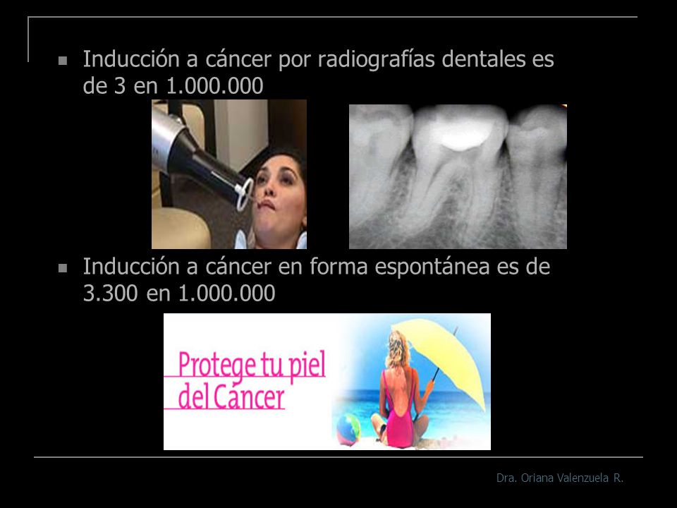 Inducción a cáncer por radiografías dentales es de 3 en